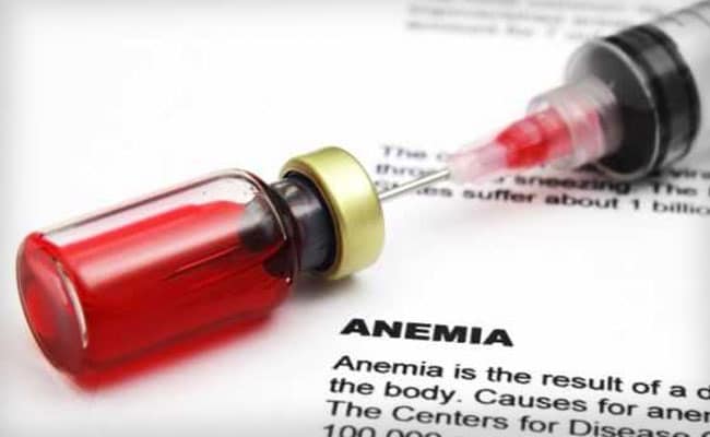 anemia