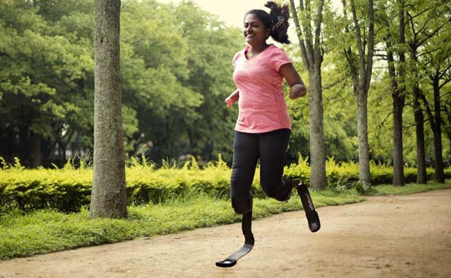 At 32, She Lost Her Unborn Baby And Her Limbs To A Rare Fever. Her Story