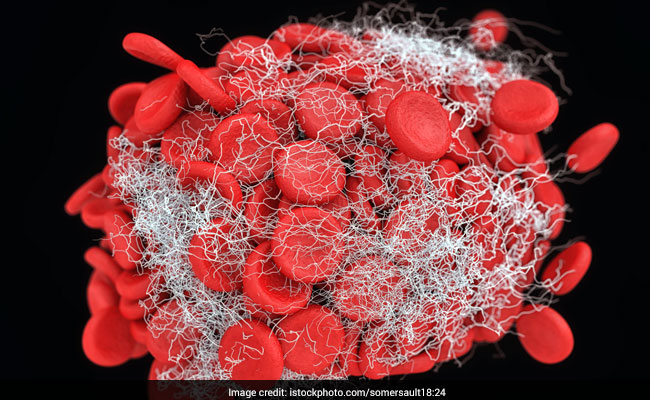 Discovered! Targeting This Blood Protein Can Help In Treating Most Neurological Disorders