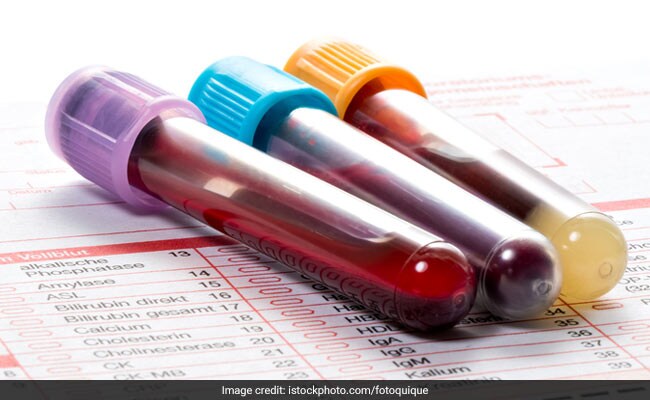 Doctor Lists Essential Blood Screenings For Men Across Different Age Groups