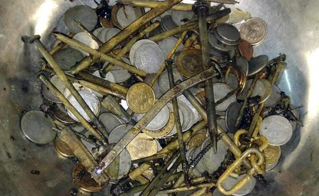 Doctors Remove 72 Coins From Stomach Of Man Suffering From Metallophagia
