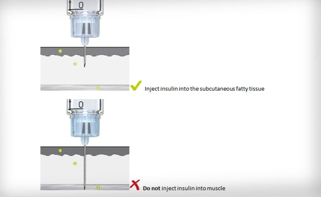 correct injection technique