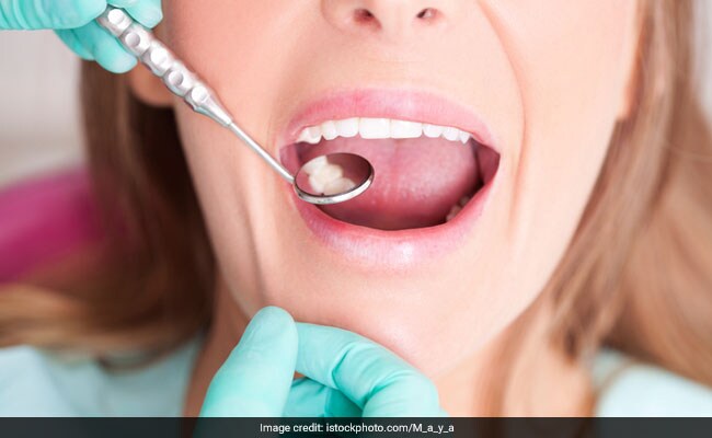 Fluorosis Disease: फ्लोरोसिस हो सकता है दातों पर दाग की वजह, जानें कैसे करें इलाज