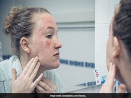 विंटर में हो रहे हैं एलर्जी से परेशान, तो ये बातें आएंगी काम विंटर में हो रहे हैं एलर्जी से परेशान, तो ये बातें आएंगी काम