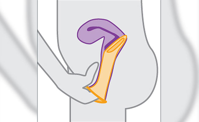10 Things To Keep In Mind If You Are Using A Female Condom