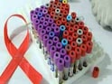 Shortage Of HIV/AIDS Kits In Blood Banks, Interesting Facts About Blood Donation