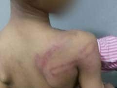 Hyderabad Kindergarten Boy Beaten Up Allegedly By Teacher