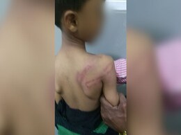 Hyderabad Kindergarten Boy Beaten Up Allegedly By Teacher Hyderabad Kindergarten Boy Beaten Up Allegedly By Teacher