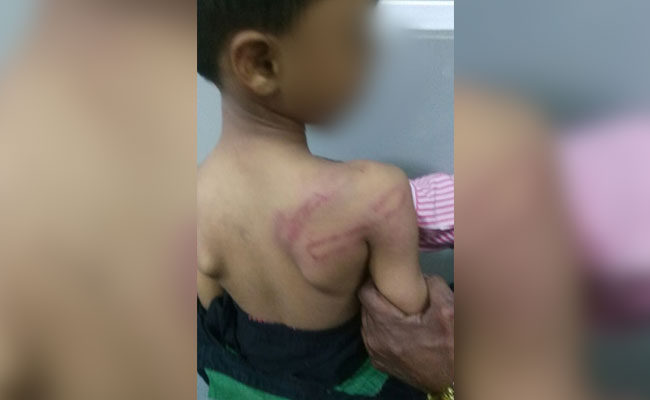 Hyderabad Kindergarten Boy Beaten Up Allegedly By Teacher