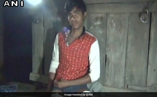 स्कूल यूनिफॉर्म पहनकर नहीं आया तो टांगों पर चला दी कैंची, किया जख्मी