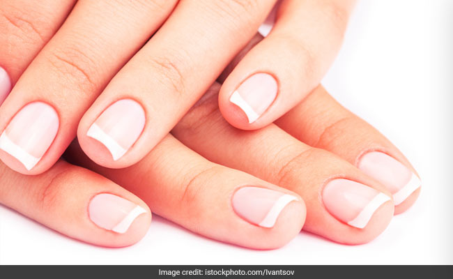 Home Remedies For Yellow Nails - नाखूनों का पीलापन दूर करने के 5 आसान घरेलू  तरीके