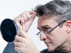 Beware! Premature Greying And Baldness In Men Ups Risk Of Heart Disease