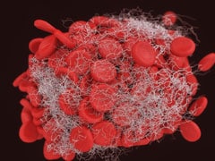 Nano Technology Offers Hope For Better Cancer Testing