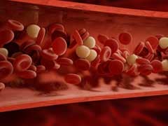 Tips To Increase Hemoglobin: शरीर में खून की कमी को दूर करने के लिए फॉलो करें ये टिप्स