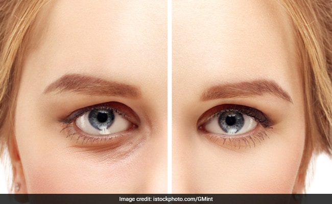 Skincare Tips: Prepare These Under Eye Masks To Get Rid Of Dark Circles  Easily