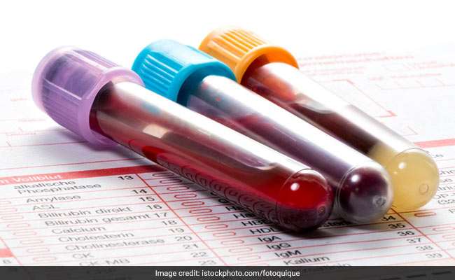 What Is Alt Sgpt In Blood Test High