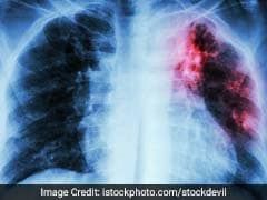 5 Signs That Your Lungs Are In Trouble