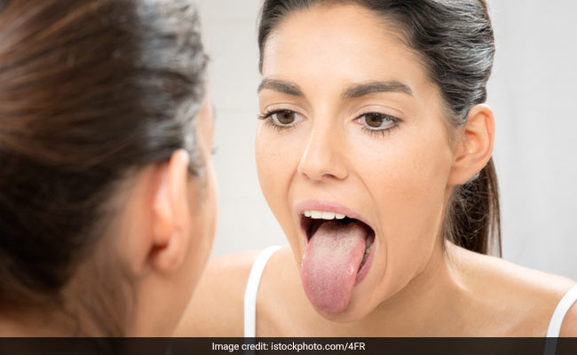 7 Possible Reasons Why There Are Dark Spots On Your Tongue