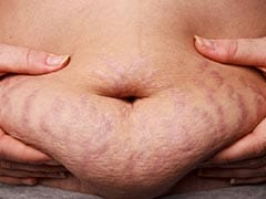 Unhealthy Belly Fat: 6 Diseases Which Could Give You Unhealthy Belly Fat