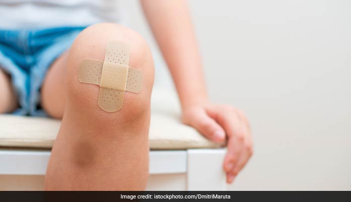 First aid for Bruise: चोट लगने से क्यों पड़ जाती है नील, जानिए कैसे कर सकते हैं इसका इलाज