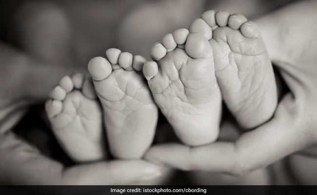 Conjoined Twins Separated After 12 Hours Surgery By 20 Doctors In Mumbai
