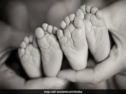 Conjoined Twins Separated After 12 Hours Surgery By 20 Doctors In Mumbai Conjoined Twins Separated After 12 Hours Surgery By 20 Doctors In Mumbai