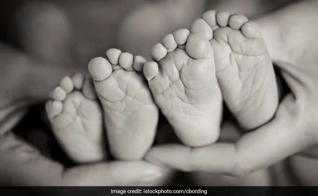 Two Sets Of Conjoined Twins Admitted To AIIMS For Surgery