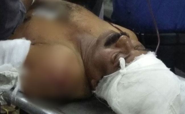 2 CPM Workers Attacked In Kerala, Police Hunt For Assailants