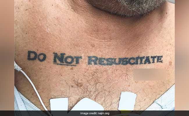 US Man's "Do Not Resuscitate" Tattoo Leaves Doctors With Life-Or-Death Dilemma