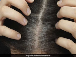 वक्त से पहले सफेद बालों की परेशानी होगी खत्म, अपनाएं ये 5 आसान तरीके वक्त से पहले सफेद बालों की परेशानी होगी खत्म, अपनाएं ये 5 आसान तरीके