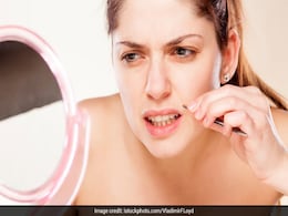 वैक्सिंग से बचने के लिए लड़कियों के हाथ लगी ये चीज़, बिना दर्द के मिलेगा बालों से छुटकारा वैक्सिंग से बचने के लिए लड़कियों के हाथ लगी ये चीज़, बिना दर्द के मिलेगा बालों से छुटकारा