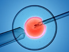 Exploring Paternal Lymphocyte Treatment As A Solution For Repeated IVF Failures