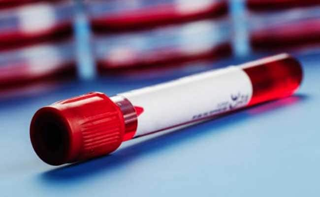 Blood Type O Ups Risk Of Death From Serious Injury