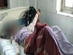 Minor Raped For Over 2 Months, Then Set On Fire in UP's Mainpuri