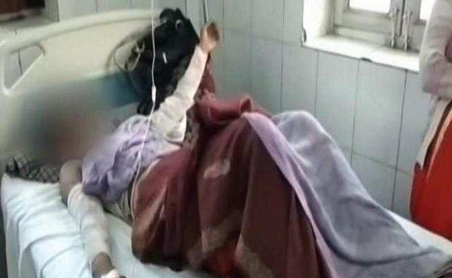 Minor Raped For Over 2 Months, Then Set On Fire in UP's Mainpuri