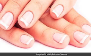 Your Nails Can Reveal Many Secrets About Your Diet!