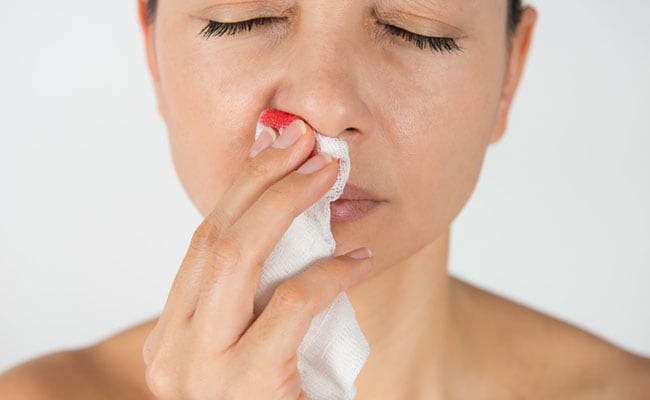 nose bleeding blood remedies stop effective throat