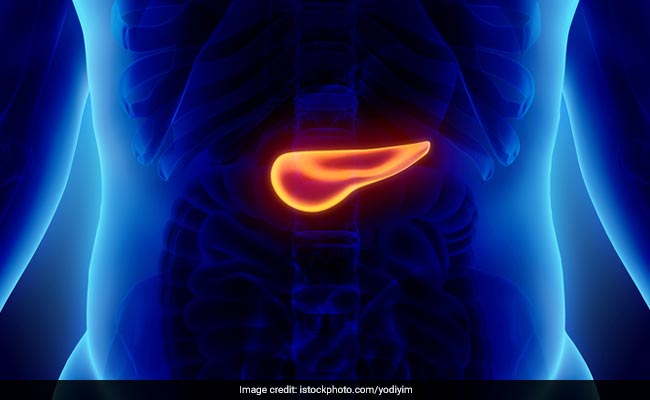 How To Spot Pancreatic Cancer In Early Stages