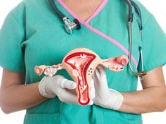 PCOS Management: Here Are Some Tips To Fight Polycystic Ovarian Syndrome Naturally; Know Symptoms And Complications