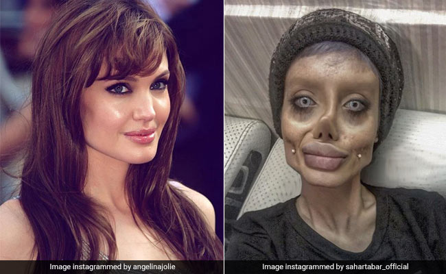 Here's All You Need To Know About Plastic Surgeries