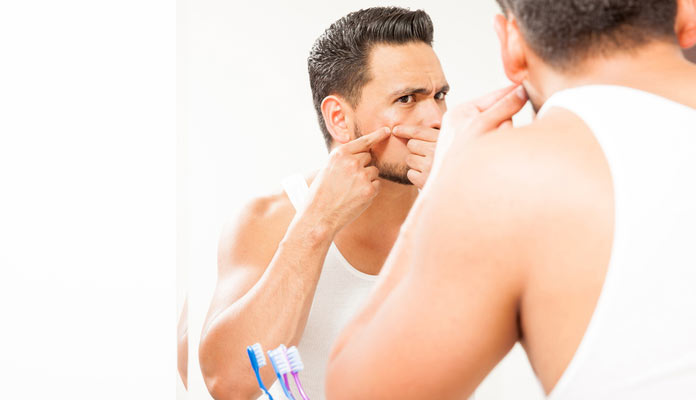 Gentlemen, Here’s How You Can Prevent An Acne Breakout