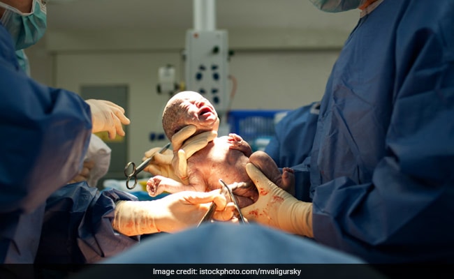 Supreme Court Dismisses Plea Seeking Guidelines On Cesarean Deliveries