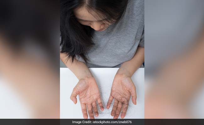 Onion The Single Most Effective Home Remedy For Hair Loss