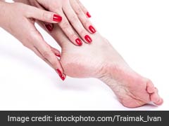 7 Effective Tips To Treat Cracked Heels