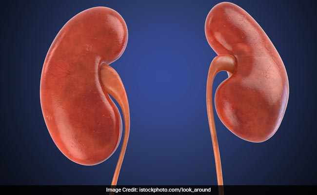 A Dad Wore A T-Shirt At Disney World That Said 'In Need Of Kidney.' It Worked