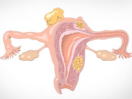 Irregular Periods: क्या हैं अनियमित माहवारी, कारण, लक्षण, इलाज, जानें पीरियड्स में क्या है नॉर्मल, क्या है ऐब्नॉर्मल? Irregular Periods: क्या हैं अनियमित माहवारी, कारण, लक्षण, इलाज, जानें पीरियड्स में क्या है नॉर्मल, क्या है ऐब्नॉर्मल?