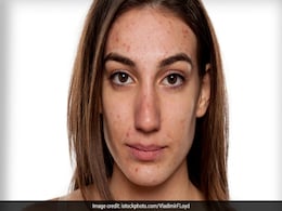 एक या दो नहीं 6 तरीकों के होते हैं पिंपल्स, जानें कैसे करें इन्हें ठीक एक या दो नहीं 6 तरीकों के होते हैं पिंपल्स, जानें कैसे करें इन्हें ठीक