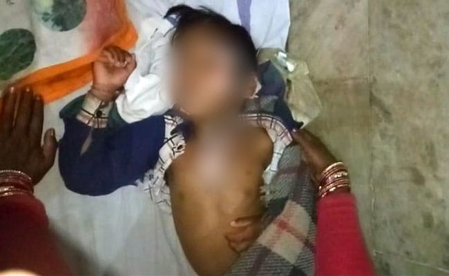 School Cook Allegedly Throws Hot Dal On Class 1 Boy Who Asked For More