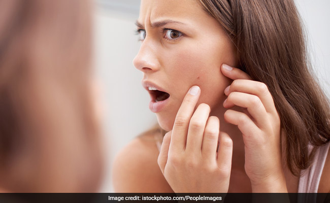 Did You Know? There Are 6 Types Of Pimples, And Each One Requires A Different Treatment