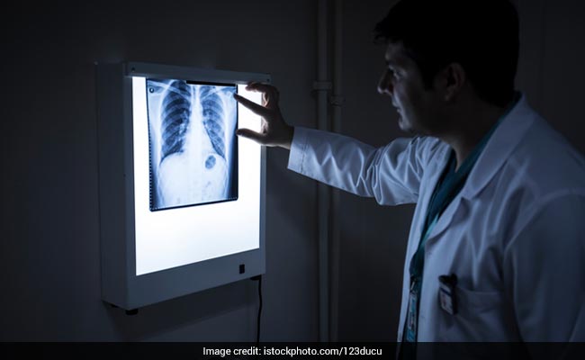 How Many Scans X-Rays Safe A Lifetime?